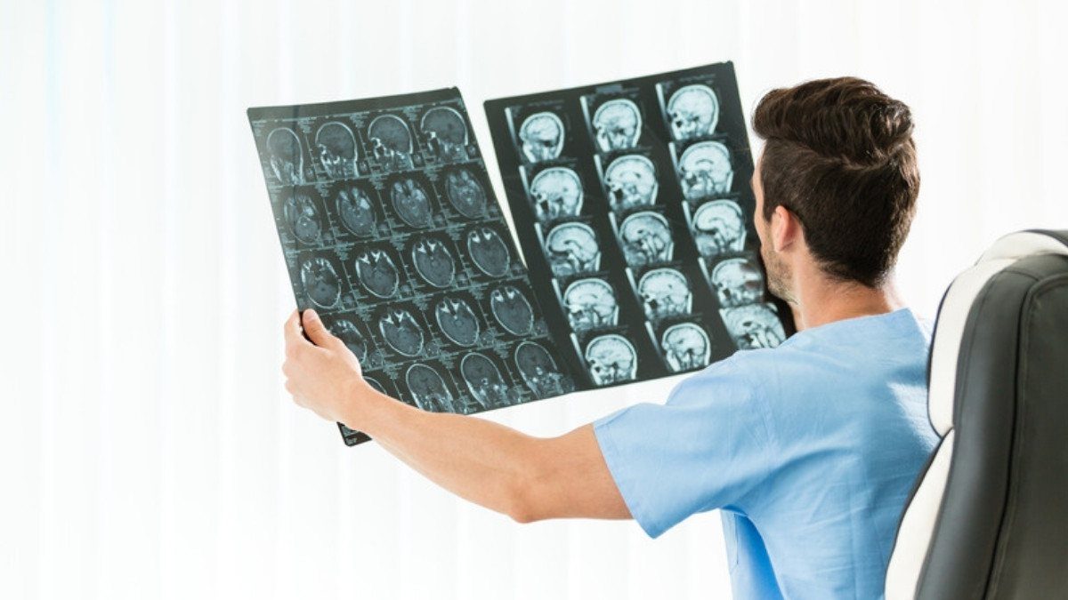 A clinician in blue scrubs holds two sheets of brain MRI images up to the window light to read them