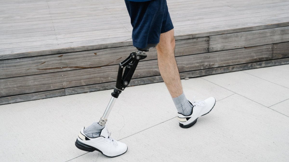 A man in shorts and white sneakers walks across pale pavement on a prosthetic leg beside a wooden step